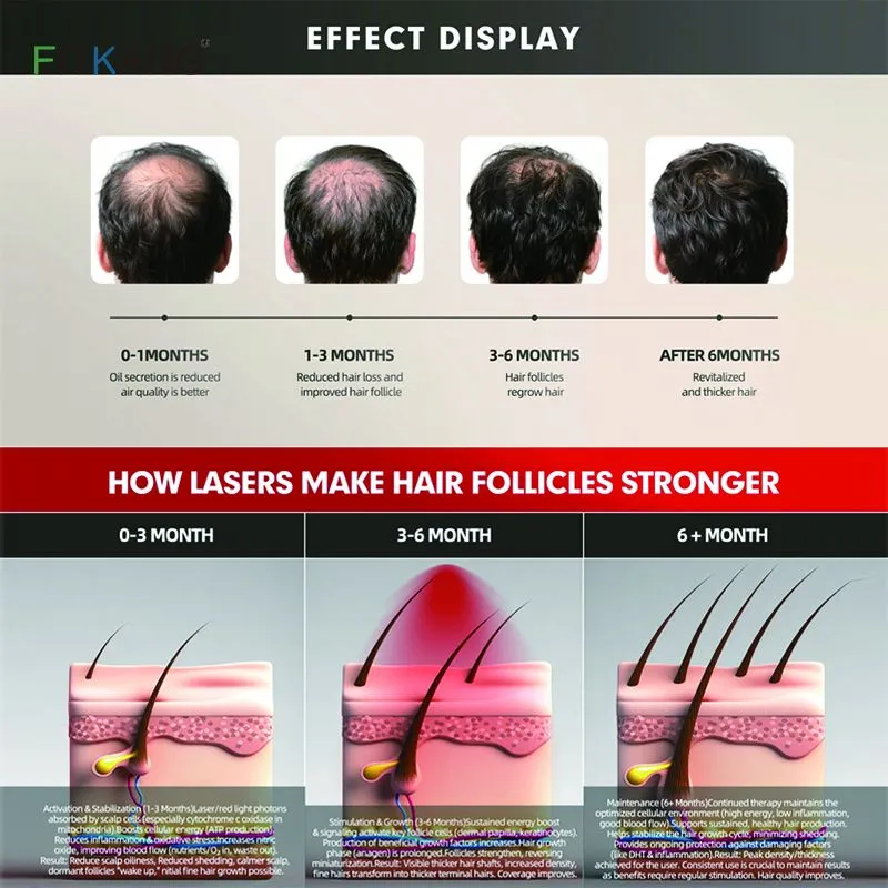 650nm Red Light Therapy Cap Hair Regrowth Laser Hair Growth Hat Helmet